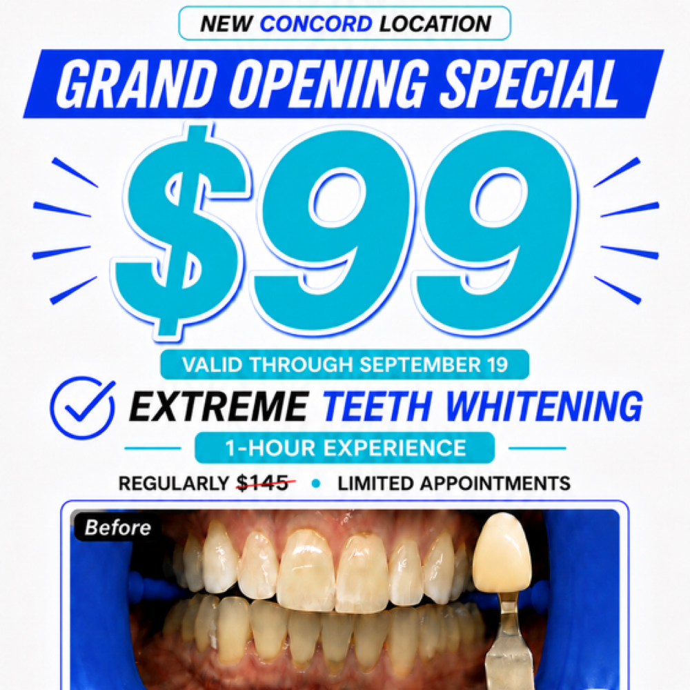 Grand Opening Special Whitening $99 at Royal Blanc Smiles - Teeth Whitening and Tooth Gems in Charlotte, NC in Concord, NC