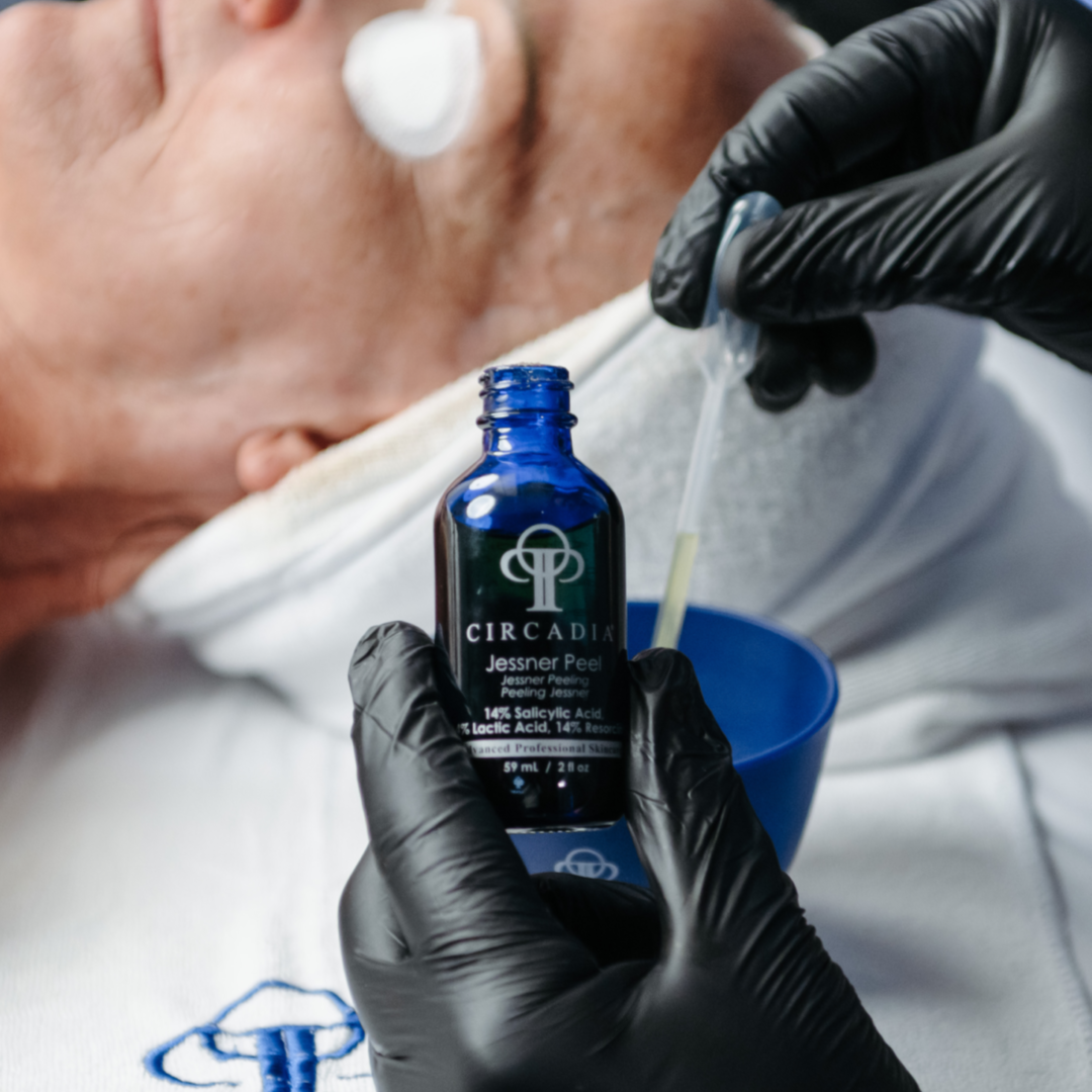 Jessner Peel at The Face Place, Skin Care by Judy in Schererville, IN