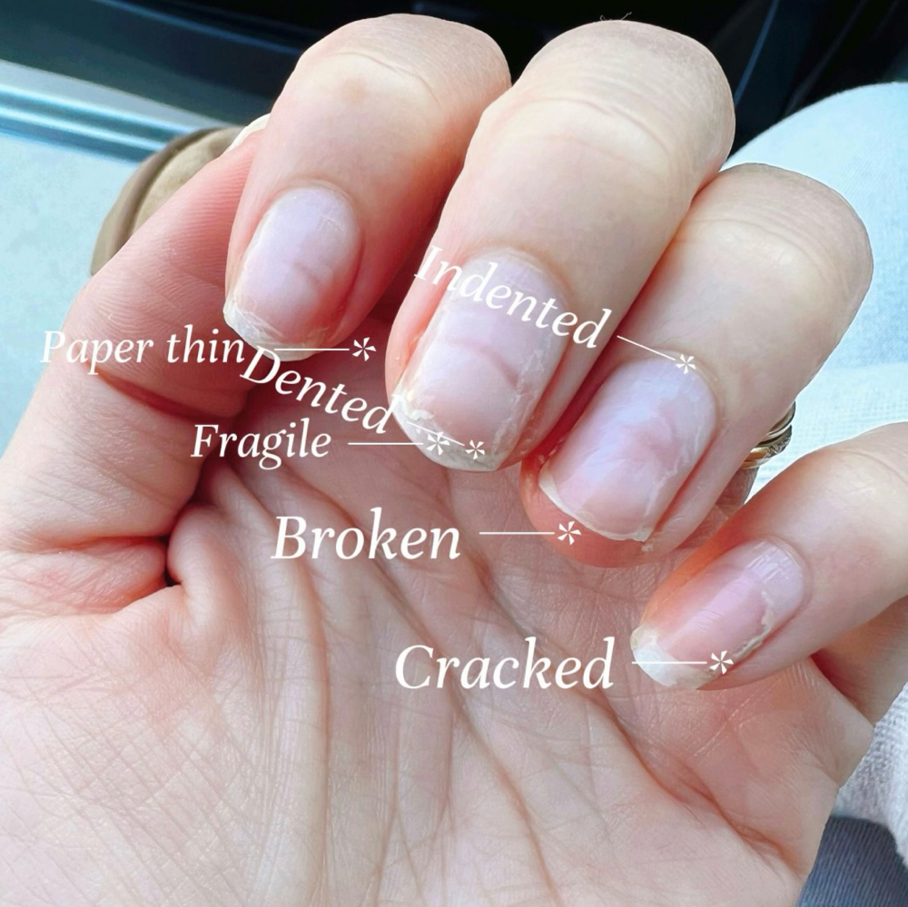 Add NAIL REINFORCEMENT