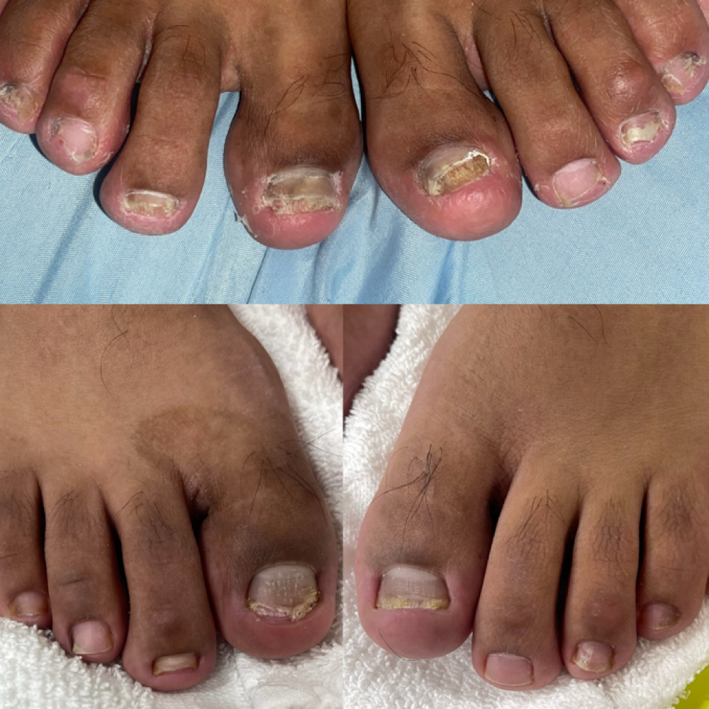Specialized Pedicure at Beauty & Essence in Moreno Valley, CA