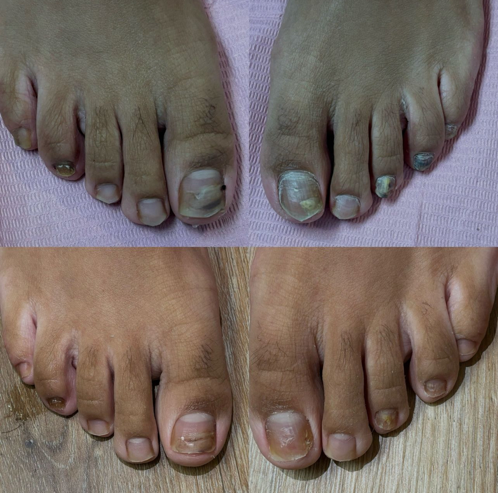 Advanced Foot Care Pedicure