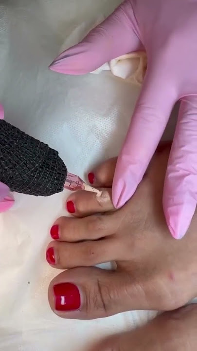 Lost Pigment On Toe (Camouflage)