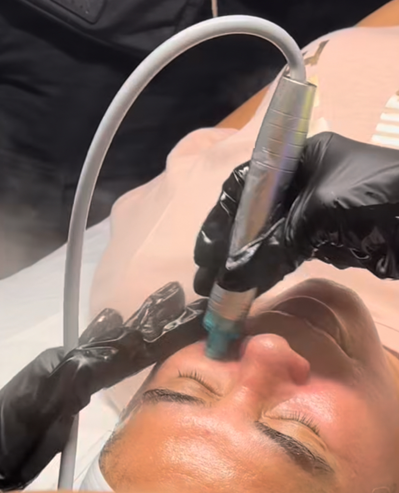 Oxygen Facial