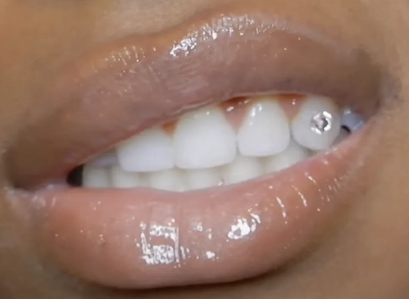 Single Tooth Gem