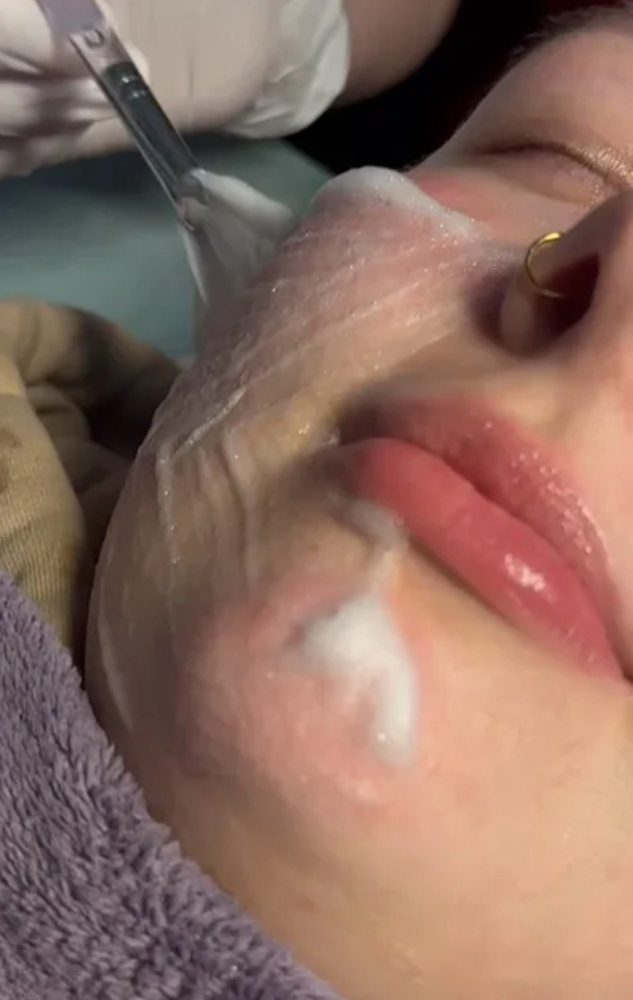 Teen Facial
