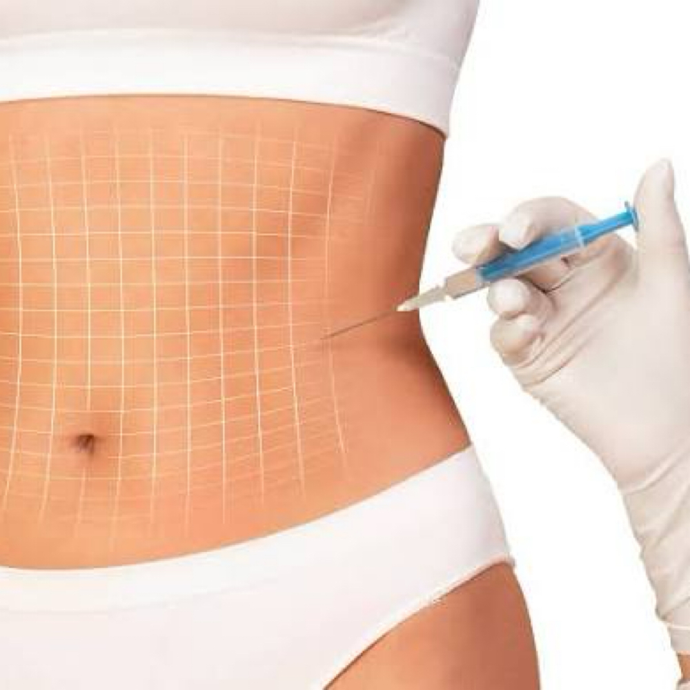 FAT DISSOLVING Injections at Irena Studio & Academy in McAllen, TX