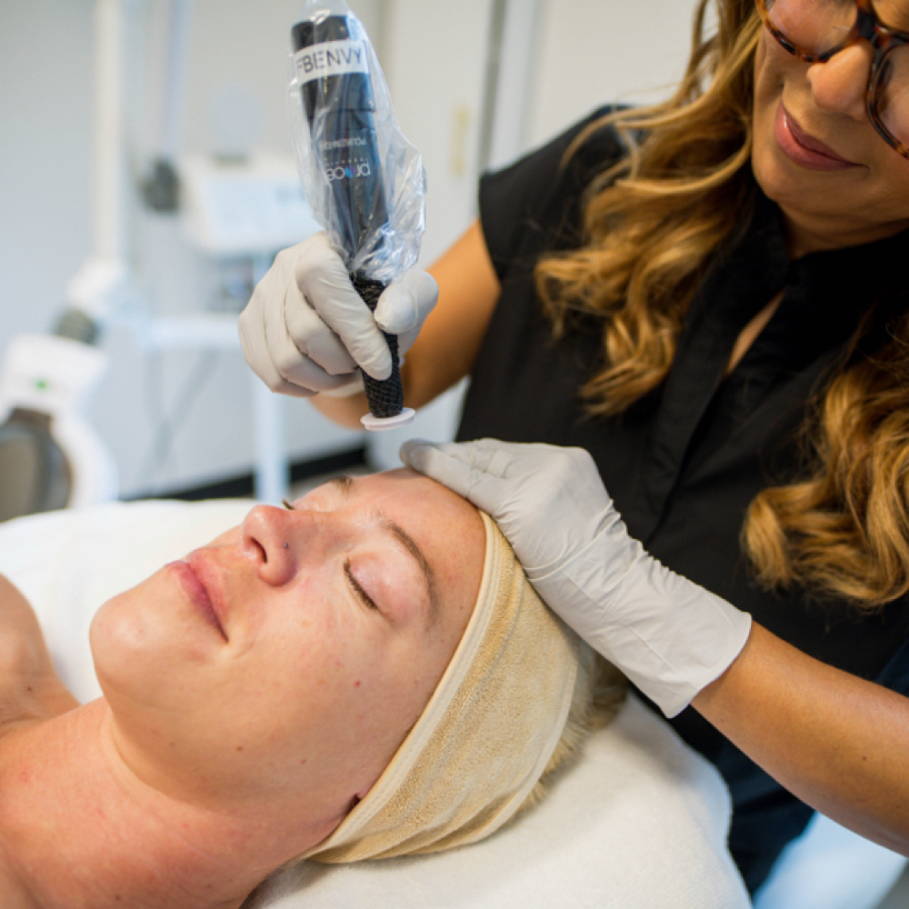 Bio Repeel+Procell Microchanneling at Face And Body Envy in Rockwall, TX