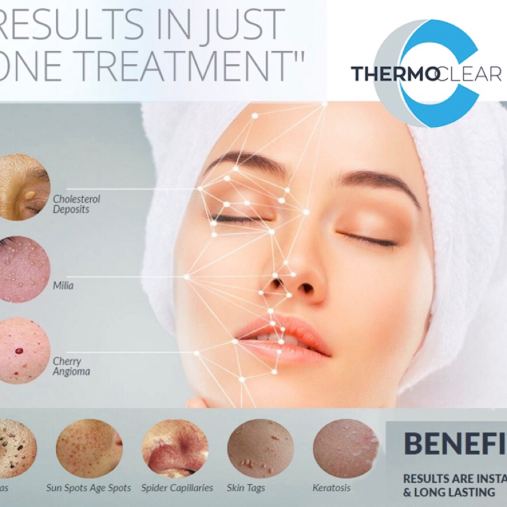 ThermoClear at Dara Heidbreder @ Shear Technique in Jefferson City, MO