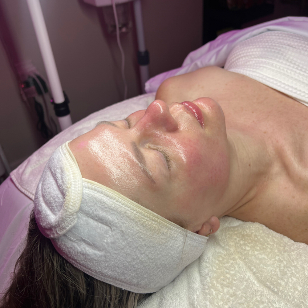 Dermaplane Glow Facial at FacebyMeriee in Williamsville, NY