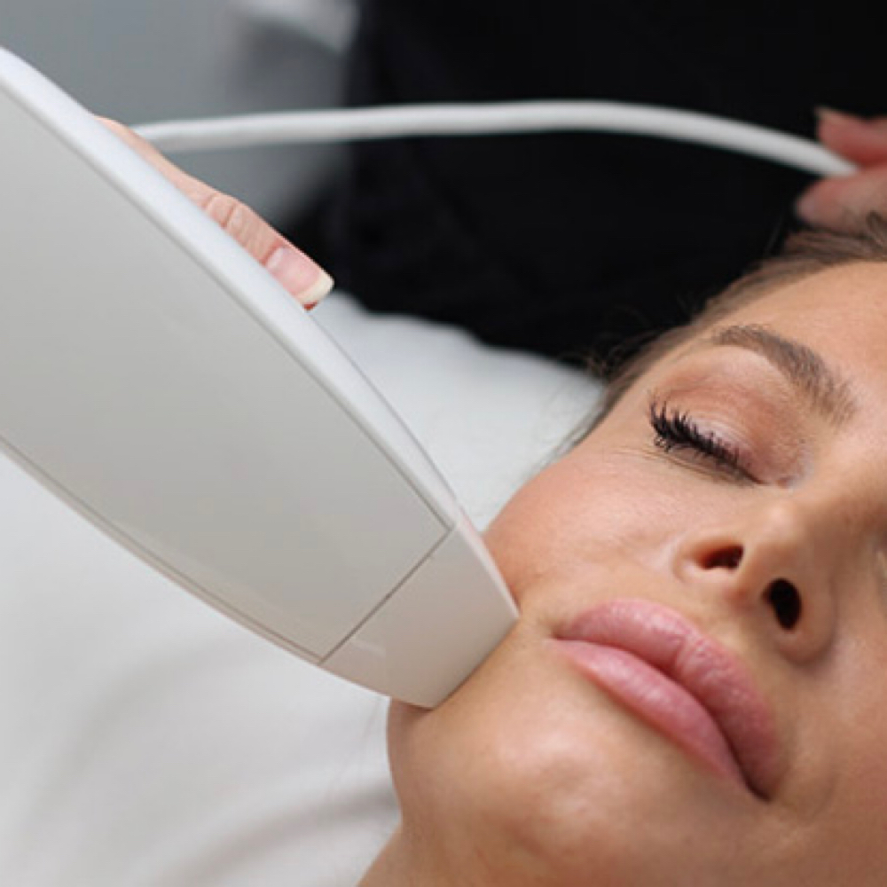 RF Microneedling at Bellissima Beauty Boutique in Chesterton, IN