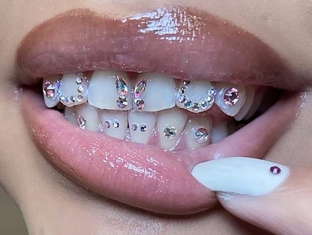 Teeth Gems