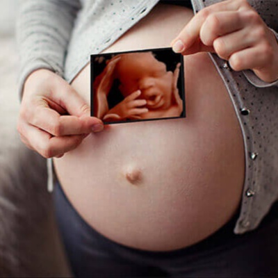 HD Live Ultrasound 5D at San Bernardino 3D 4D Ultrasound by 4D Special Delivery in San Bernardino, CA