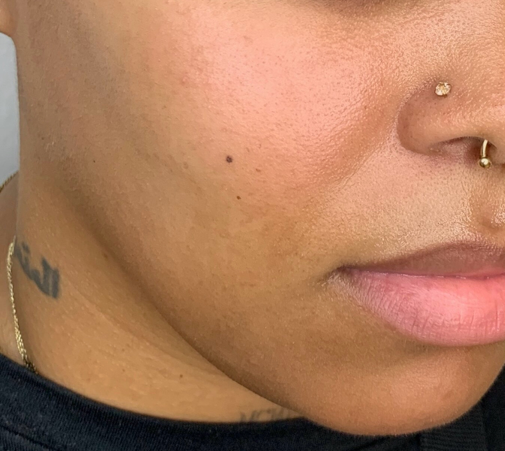 MICRO TATTOO