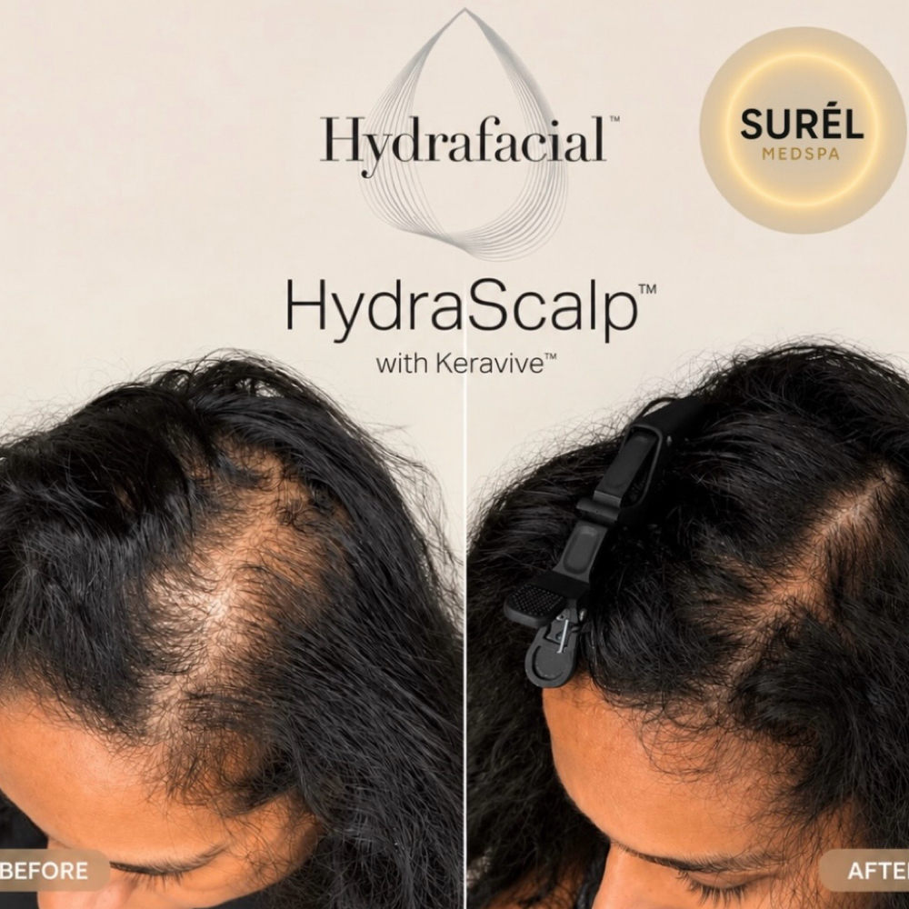 Keravive Hair Restoration at Anfissa Beauty in Mount Angel, OR