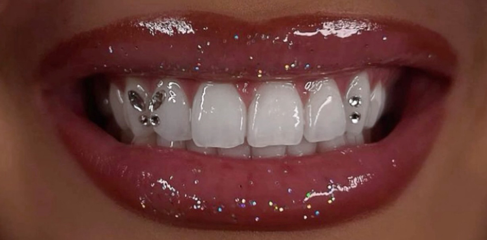 Butterfly at Nabi Aesthetics in Nashville, TN