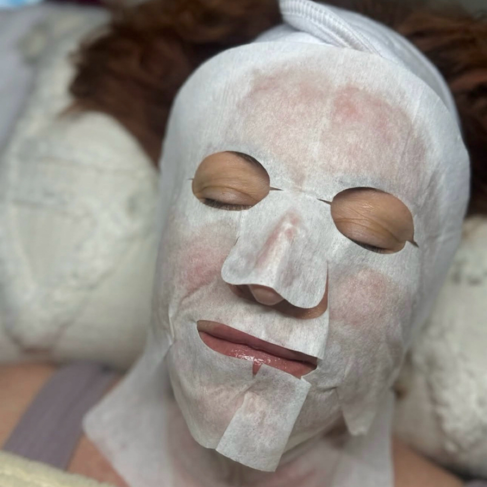 ✨ Carboxytherapy – The Breath of Yo at Viva Viktoriya LLC in Boca Raton, FL