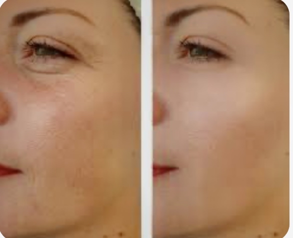 CALMING ROSACEA FACIAL