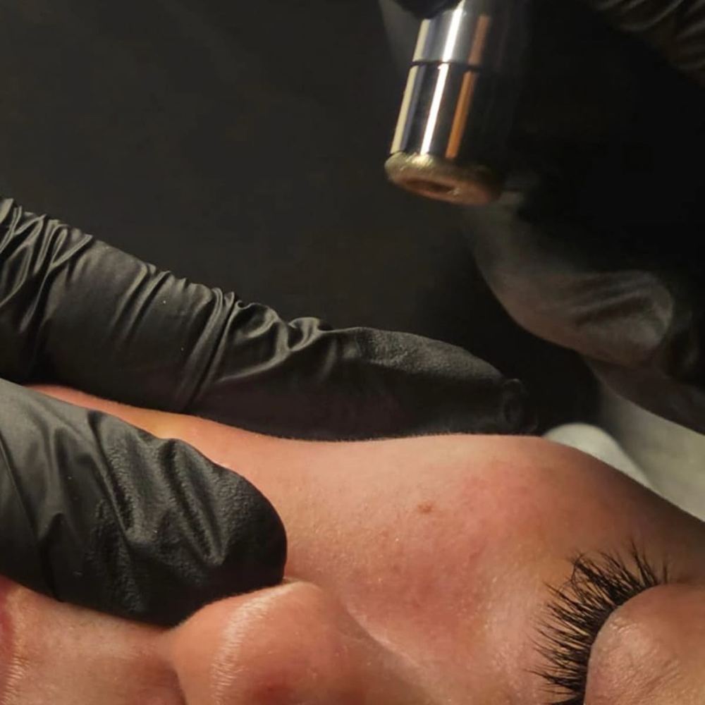 DIAMOND GLOW MICRODERMABRASION at VeLure Skin Esthetics in Sylmar, CA