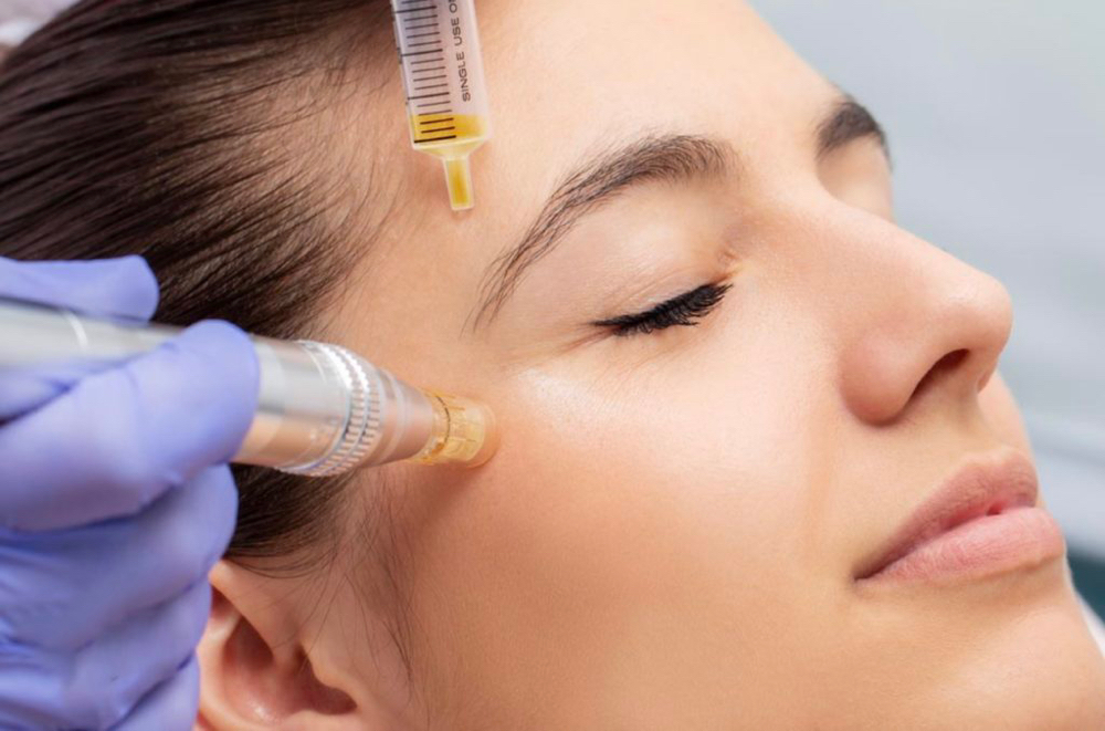 Microneedling + Stemcell Injection