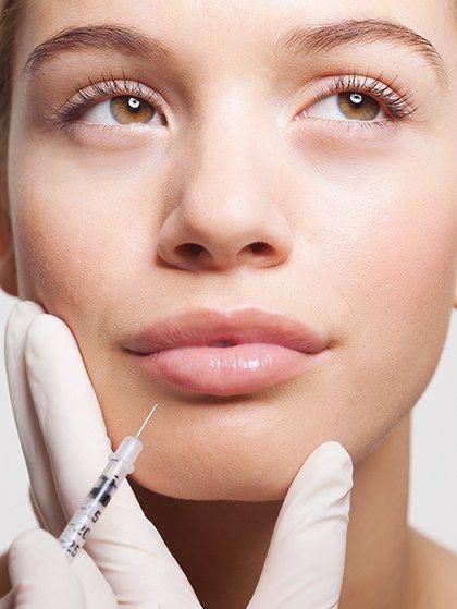 Dermal Filler