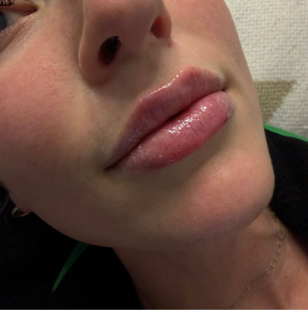 LIP FLIP✨ at InjectorFaiiry in Greenville, TX
