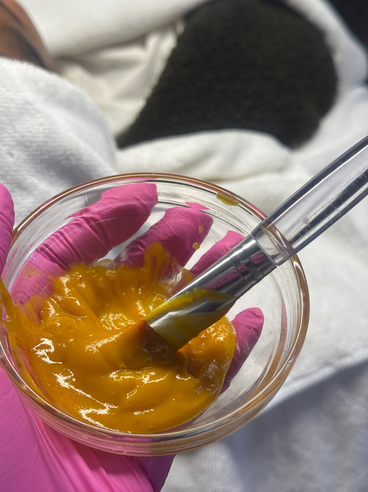 Corrective Pumpkin Chemical Peel