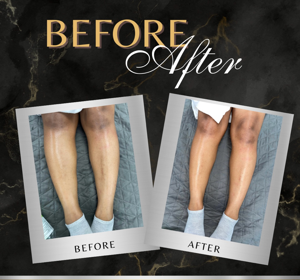 Lower Leg Wax