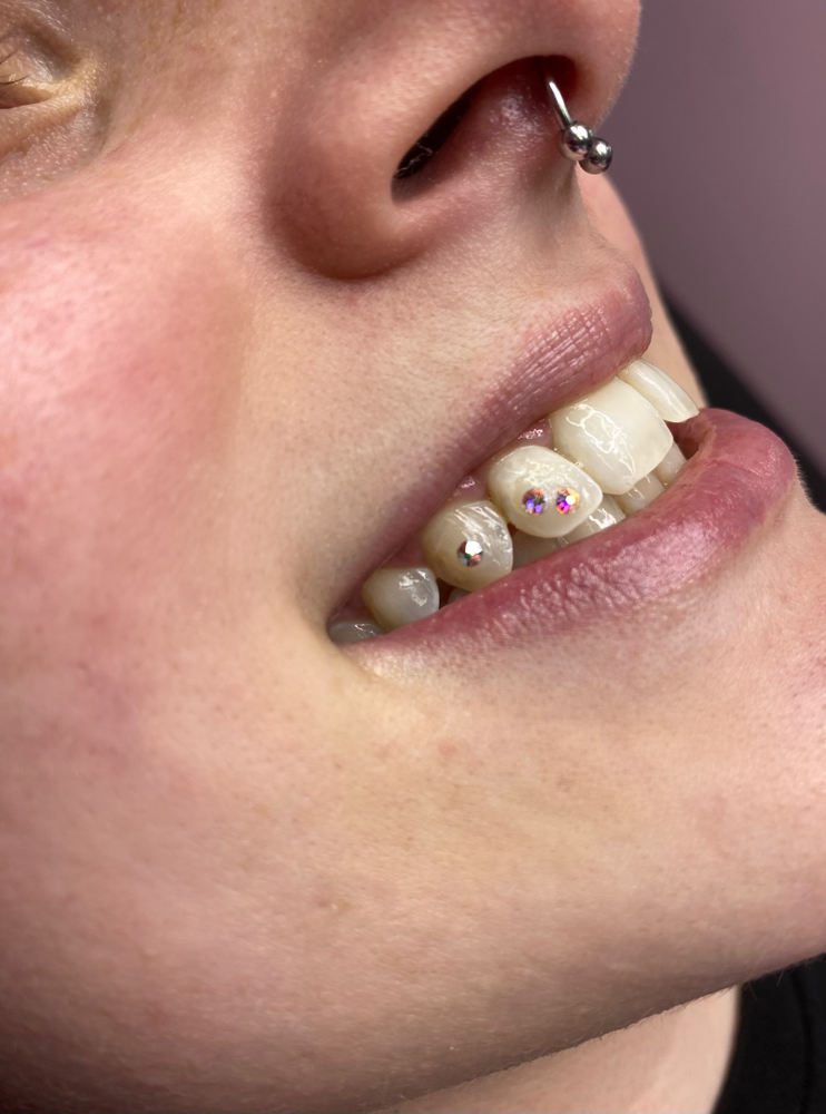 TOOTH GEMS