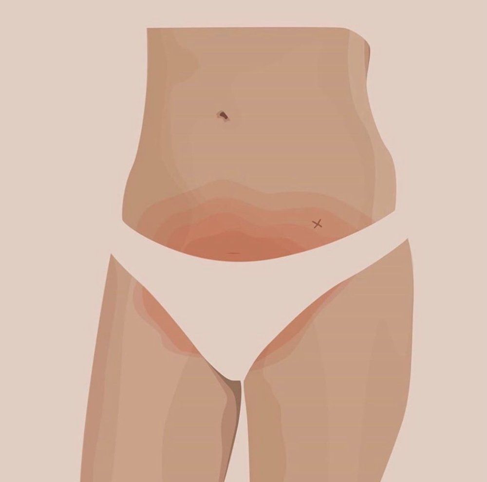 Bikini Wax at Zealus Skincare in Chesapeake VA, VA