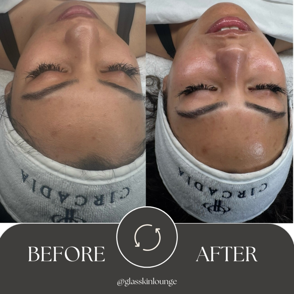 Facial Brillante