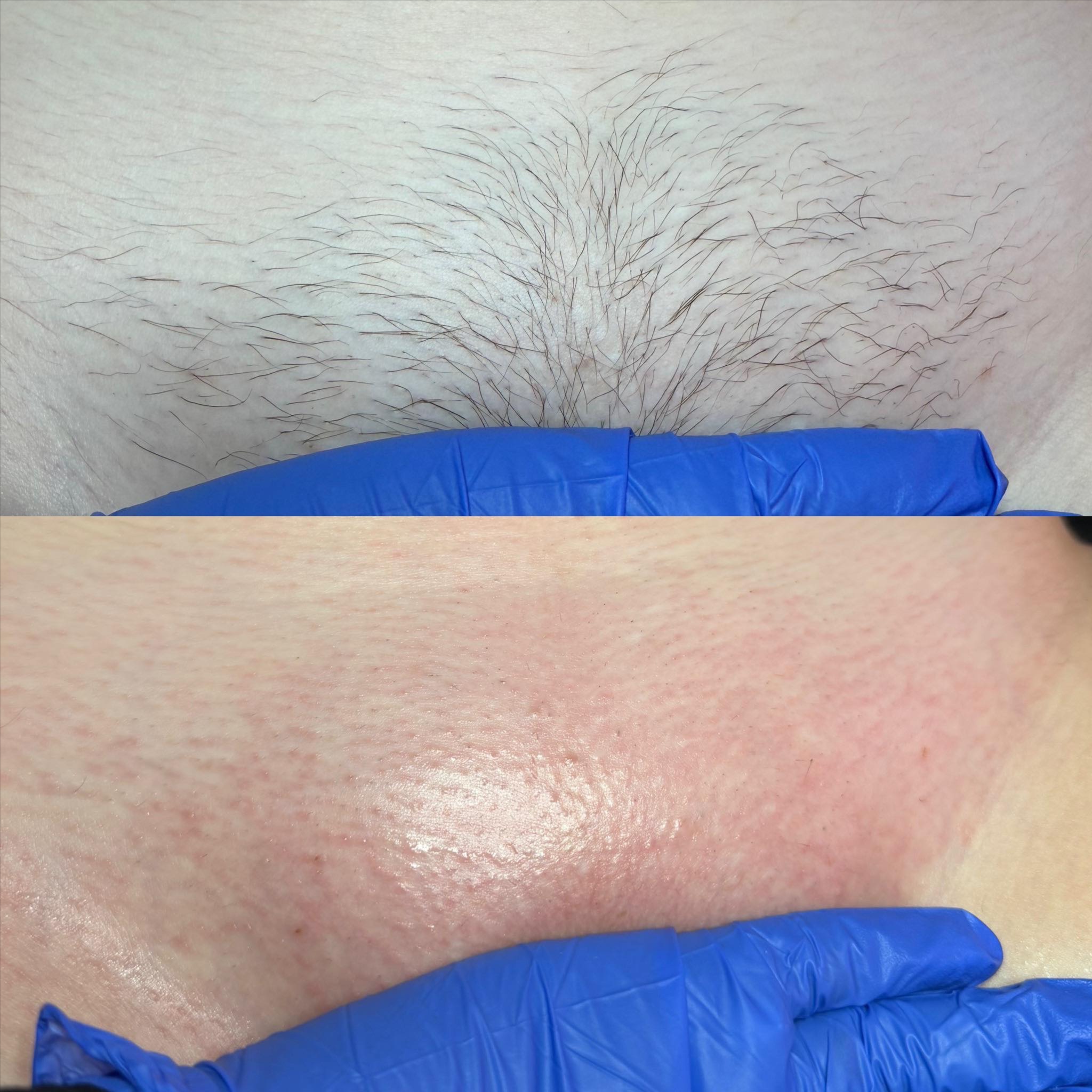 Brazilian at Emma Dexter Esthetics in madisonville, KY