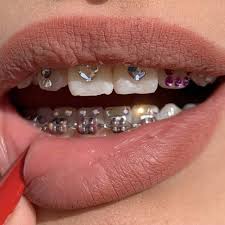 Tooth Gems at Eximius Bella in Garner, NC