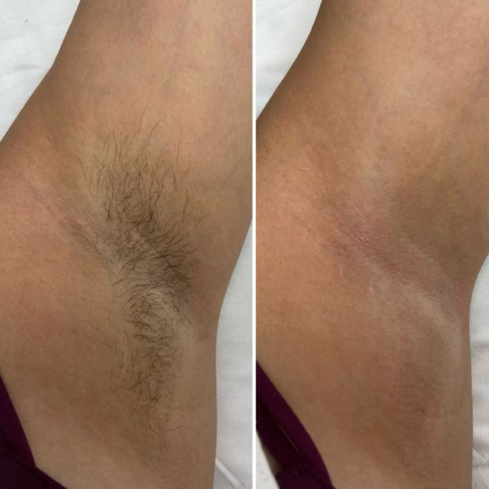 Under Arm Wax