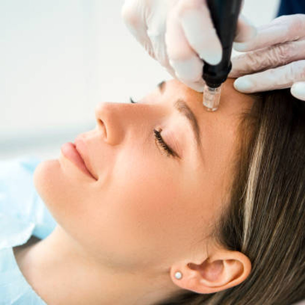 Hydrodermabrasion Treatment