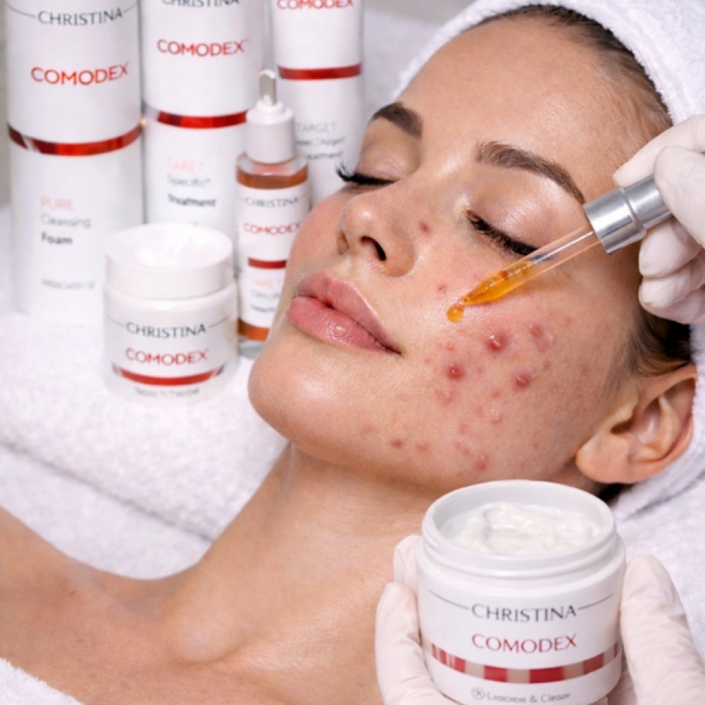 Acne & Oily Skin Treatment at NAUMA Skin & Laser Studio in Rockledge, FL