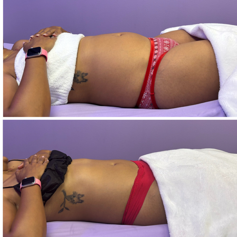 Lymphatic Drainage VIP Membership at Divinity Essence Spa in Winter Springs, FL