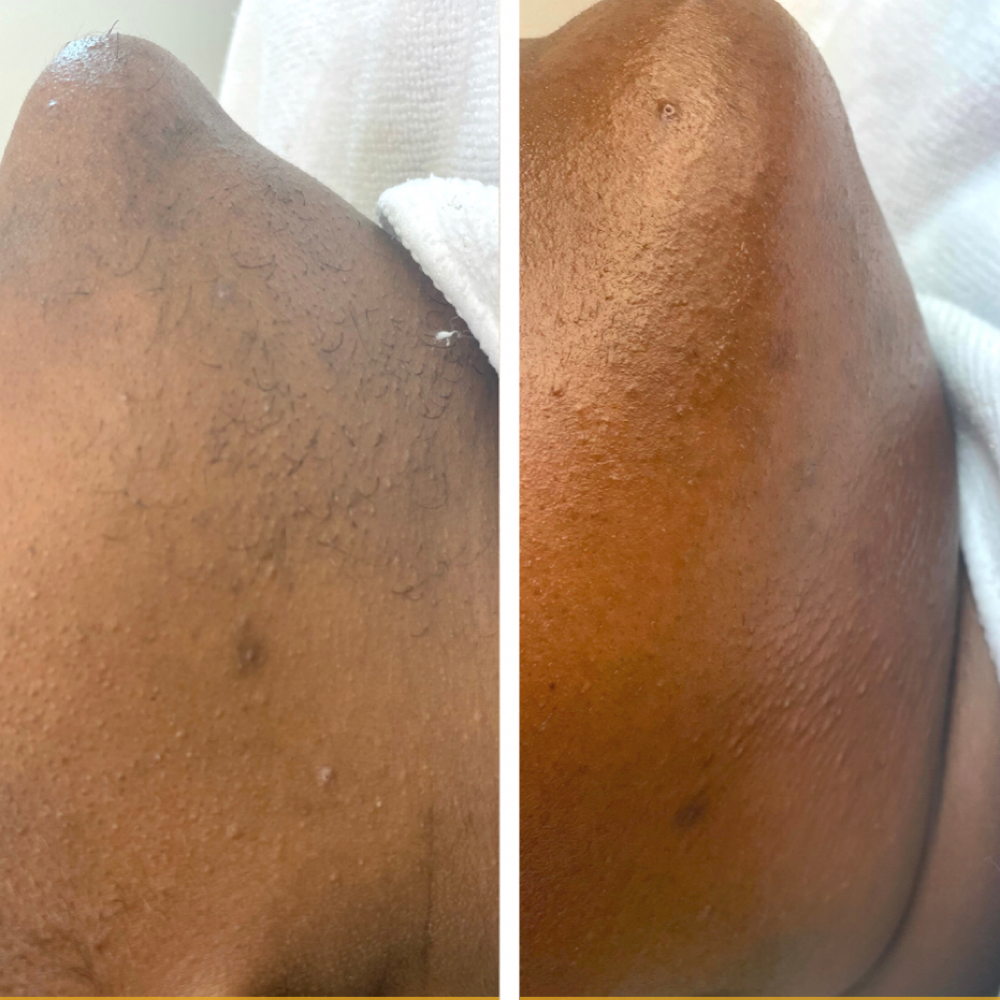 Half Face Wax at SKYNSENSE in Pikesville, MD
