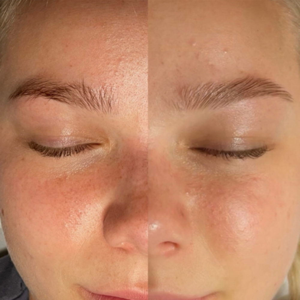 Eyebrow Lamination at Timberly B Esthetics LLC in Hoschton, GA