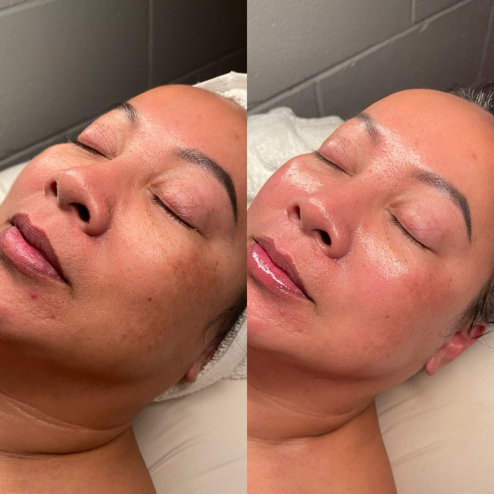 Signature Custom Facial