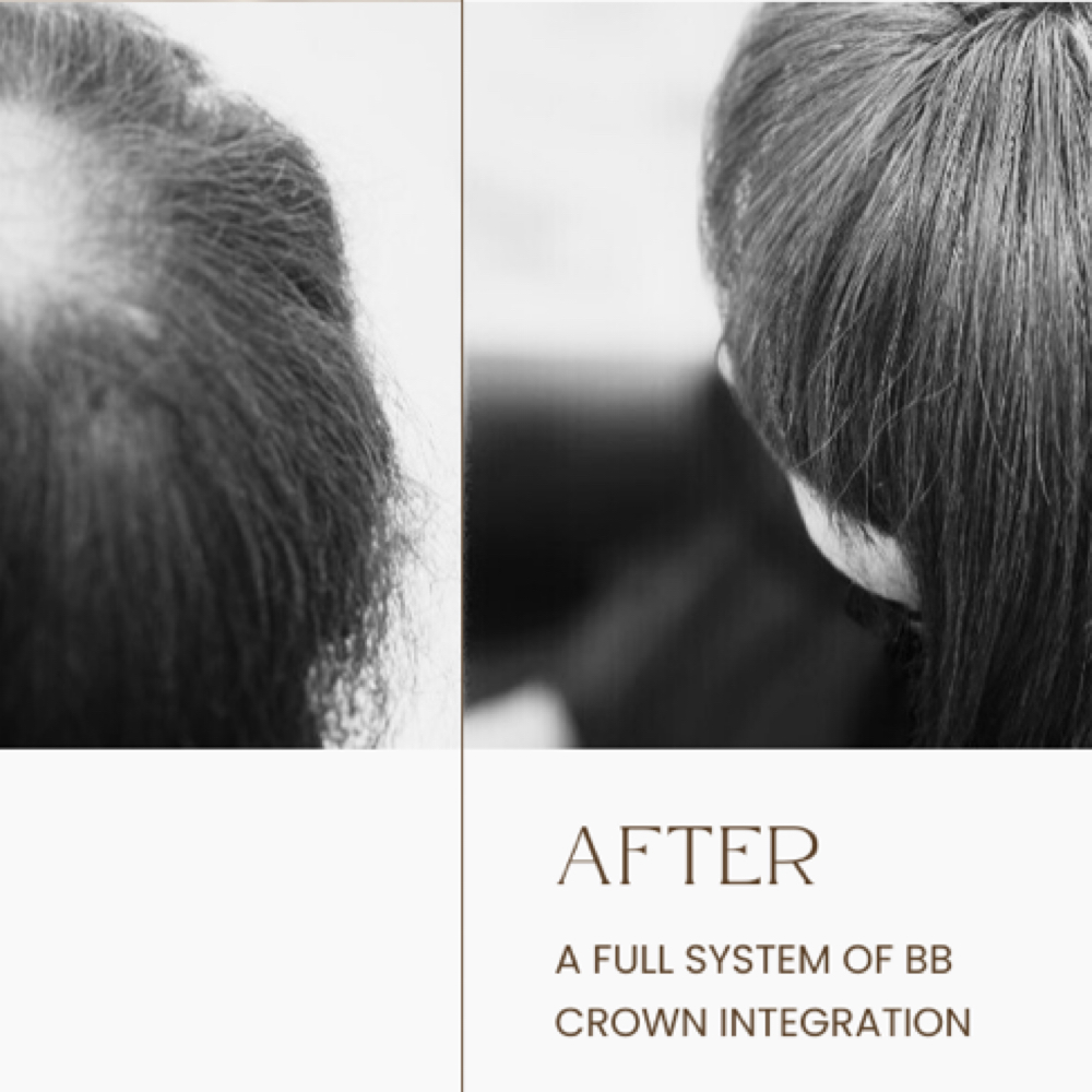 Mesh Integration/ Hair Loss App at Blond Bungalow in Berkeley, CA