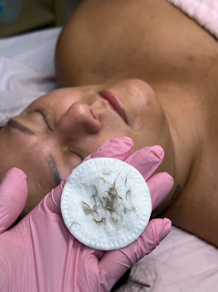 Dermaplane Glow Facial