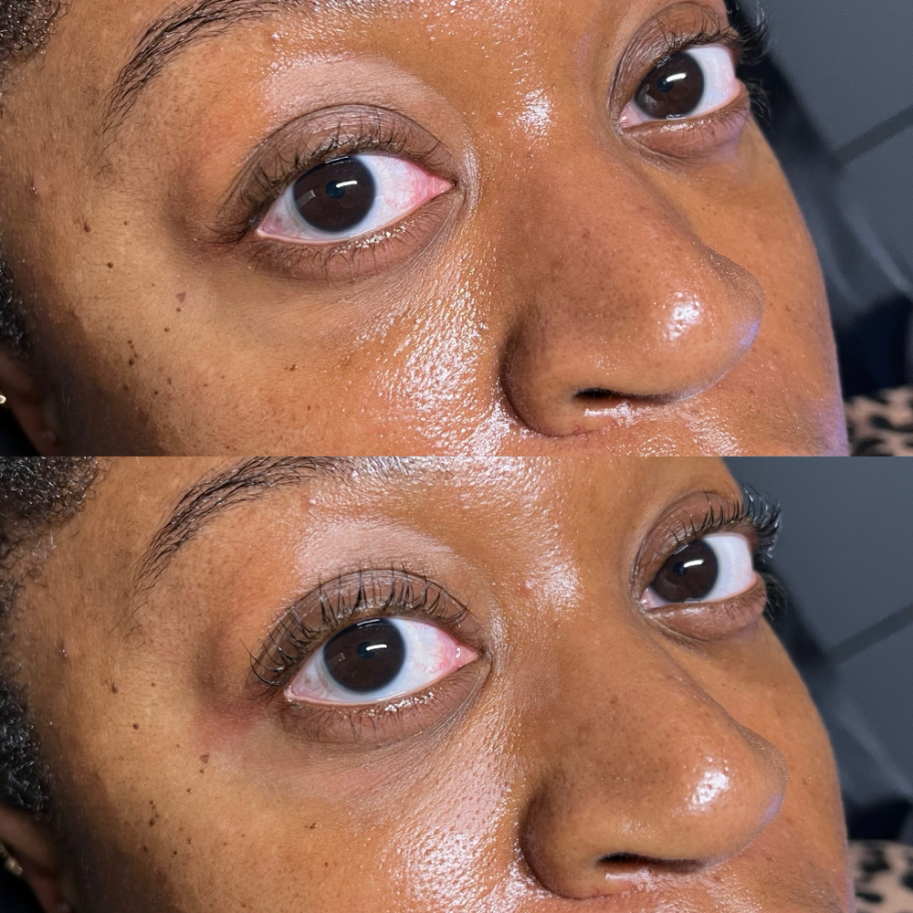 Lash Lift
