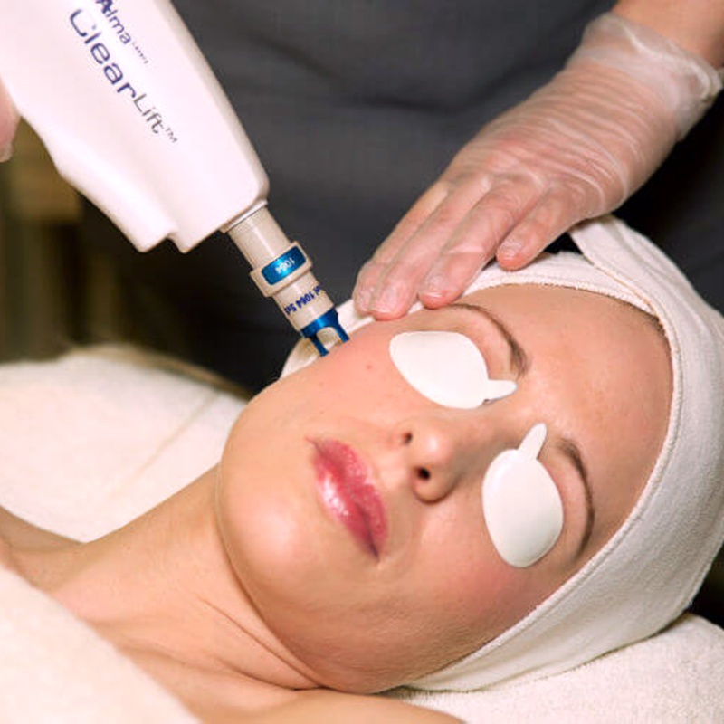 ClearLift laser facial face at The Laser Collective in Gilbert, AZ