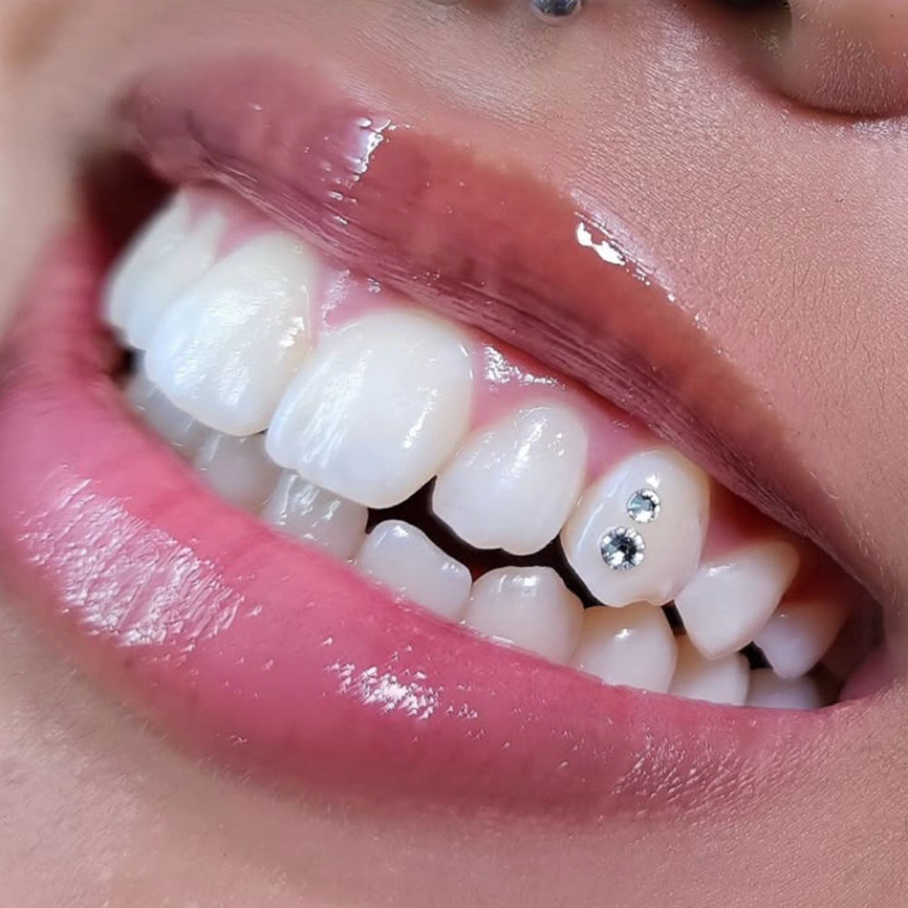 Havynn Smile Gems 💎 Simple at The Havynn For Beauty in Colorado Springs, CO