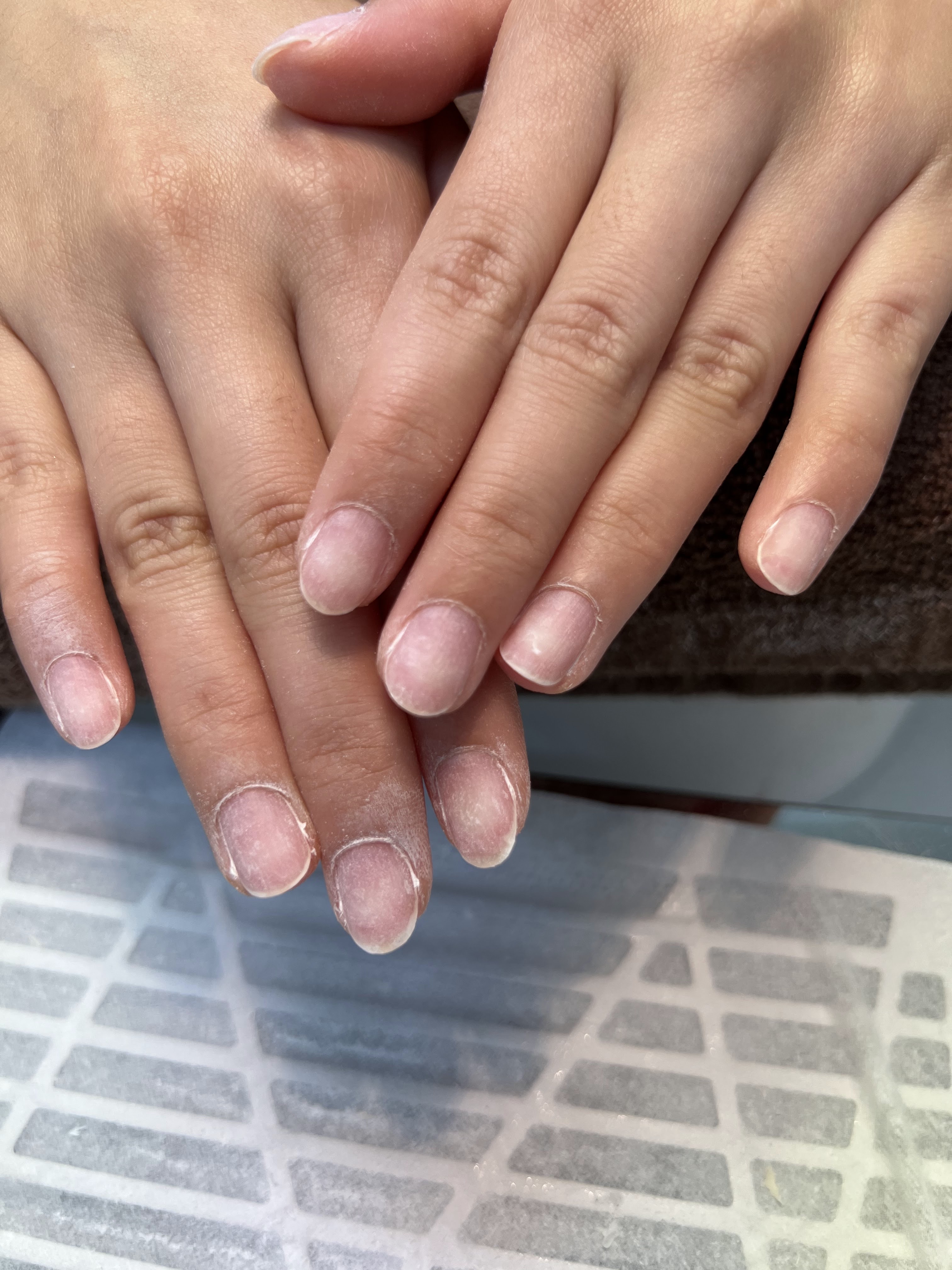 Removal w/o gel application