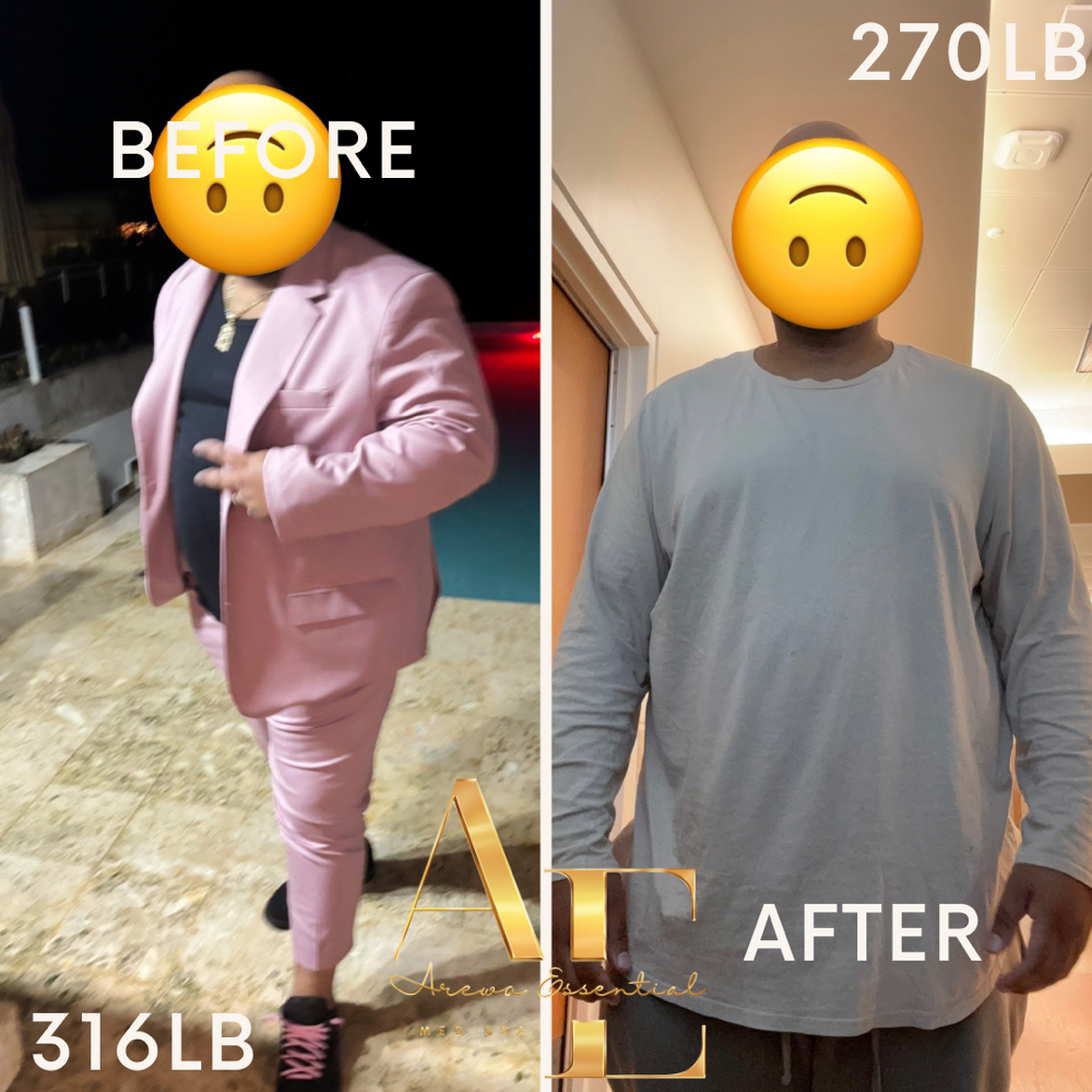 Weighloss Mangament at Arewa Essential Medspa in Mamaroneck, NY