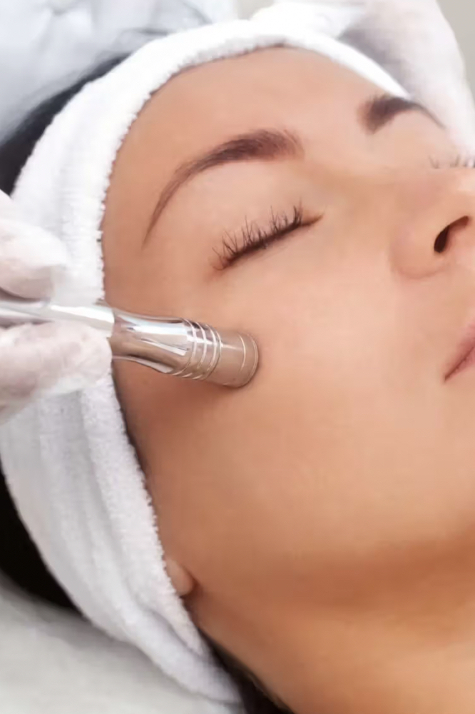 Microdermabrasion Facial