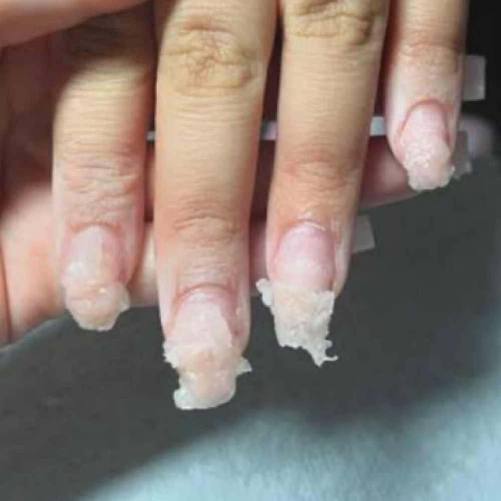 Nail Fix/ Removal at HunniTips in Mesquite, TX