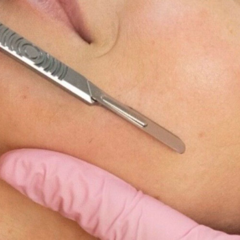 Dermaplane Only at Uplift Aesthetics in Union City, TN