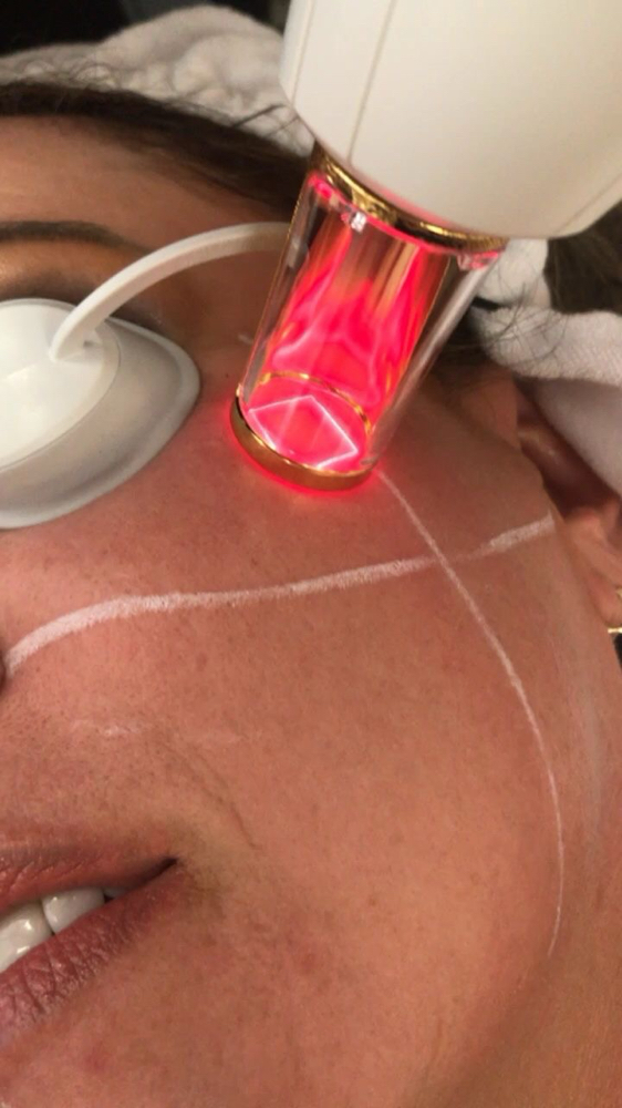 ResurFX